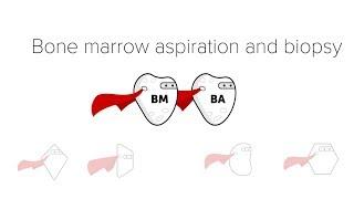 Bone Marrow Biopsy & Aspiration (BMBx)