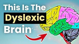 Dyslexia and ADHD - The TRUTH About Being The "Stupidest" Person In The Room | Kate Griggs