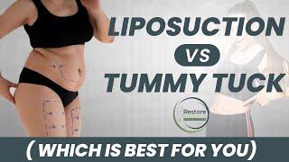 Liposuction vs Tummy Tuck | Benefits of Tummy Tuck Surgery | Restore Aesthetic Mumbai