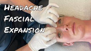 Fascial Expansion: MSR Headache Protocol