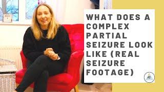 What does a Complex Partial Seizure/ Focal Impaired Awareness look like? *Real seizure footage*