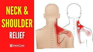 How to Fix Neck and Shoulder Pain FOR GOOD