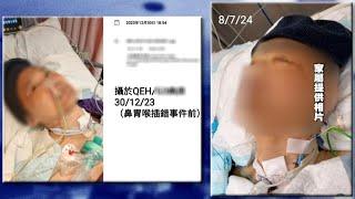 插錯胃喉入支氣管瀕死  院方認為ICU搬至加護病房對治療沒影響