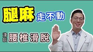 醫學專欄 3／腿麻 1 腰椎滑脫要開刀嗎／腳麻走不動／大安國際物理治療中心／Amazing International Clinic