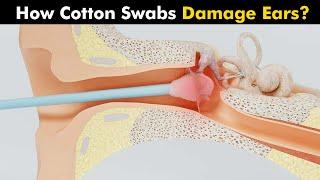 How Cotton swab Damage The ears? | Are Cotton swabs Harmful? (Urdu/Hindi)