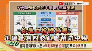 你是血栓體質嗎? 正確量測四肢血壓預防中風【健康2.0精選】