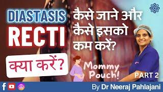 प्रेग्नन्सी के बाद पेट निकला हुआ? How to detect & avoid Diastasis Recti? Prt 2 - Dr Neeraj Pahlajani