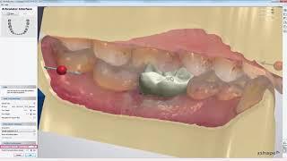 3DBioCAD - 3Shape Dental System Digital Model Design