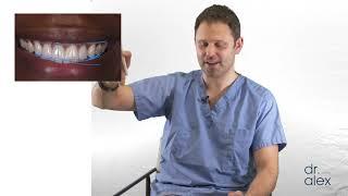 Dental Science Smile Refined - Dr. Alex Rubinov - Cosmetic Dentist in NYC