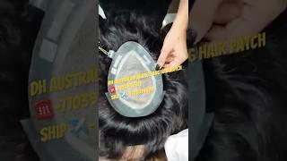 9x6 hair patch ! Australia hair patch mirage #salon #belajarsalon #barbar #barbie #transplants