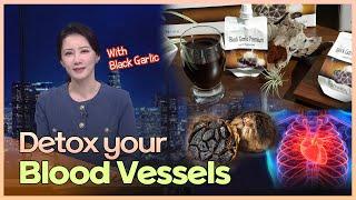 (English) Black Garlic: The Ultimate Artery Cleanser