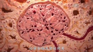 【發現】精華影片 - 20140125 - 人體奧秘系列 - 人體的淨水器 - 腎臟