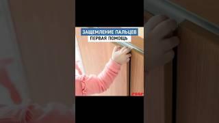 Первая помощь при защемлении пальцев ребёнка 