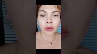 Revitalização Labial