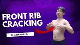 Front Rib Cracking, Costochondritis, HELPED by Dr Suh