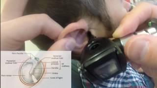 Examination of the External Ear