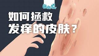 你怎么又皮痒了？如何消灭皮肤癣？Why are you itchy again? How to eliminate ringworm?