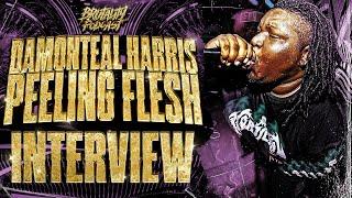 DAMONTEAL HARRIS (PEELING FLESH) INTERVIEW