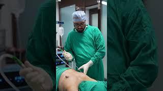 Gynecomastia Surgery cost #shortvideo #shots #dezireclinicindia