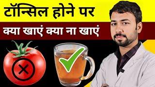 टॉन्सिल होने पर क्या खाएं क्या ना खाएं | Tonsils ka ilaj | Tonsils treatment | Tonsils Home remedy