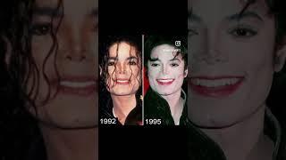 The Evolution of Michael Jackson’s Nose (7+ Nose Jobs)