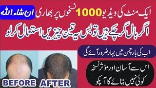 Ganjapan ka ilaj | hairfall treatment in urdu by farooqi dawakhana | گنجے پن کا علاج | #home_remedy