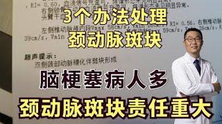 脑梗塞病人多，劲动脉斑块责任大！医生教你3个办法解决它！