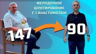 СБРОСИЛ 57 КИЛОГРАММ! Желудочное Шунтирование - Интервью с пациентом