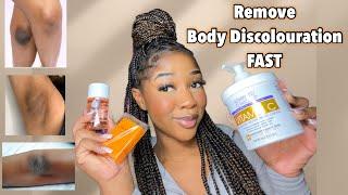 HOW TO GET RID OF BODY DISCOLOURATION FAST | Easy & Simple Routine  ft BetterHelp