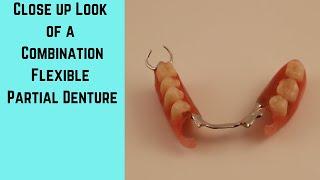 Flexible Partial Denture, a close look at a combination flexible partial denture.