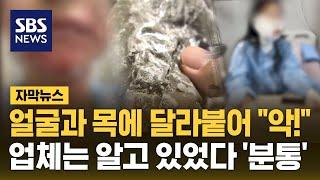 얼굴과 목에 달라붙어 "악!"…업체는 알고 있었다 '분통' (자막뉴스) / SBS