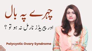 Periods Stop & Hair on Face Issue - PCO's Issue - Polycystic Ovary Syndrome - Dr Maryam Raana