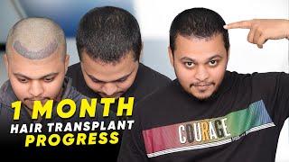 Hair Transplant in India | Best Results & Cost of Hair Transplant in India