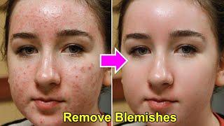 Remove Blemishes and Smooth Skin | Sadesign Panel