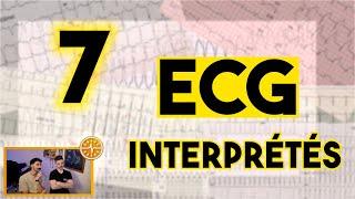 7 ECG interprétés en live ! (rediffusion)