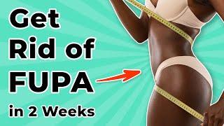 Get Rid of FUPA in 2 Weeks  Amazing Result!