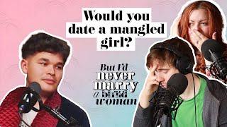 Would you date a mangled girl? | But I'd Never Marry A Blind Woman