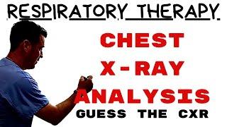 Respiratory Therapy - Key Radiographic / X-ray Findings for Cardiopulmonary Diseases Part 1