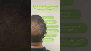 Thinning, or feeling like your hair’s lost its spark? Results Laser Clinic #hairlosstreatment
