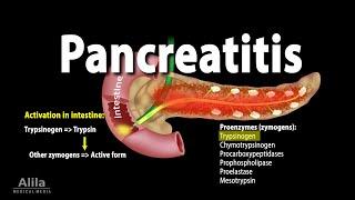 Pancreatitis, Acute and Chronic, Animation