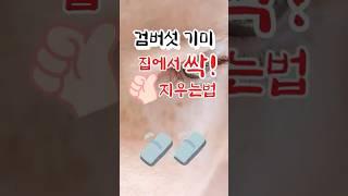 검버섯 기미 집에서 싹 지우는 방법!! #기미 #검버섯 #저승꽃 #건강이최고 #건강관리 #건강정보 #피부관리 #건강 #바나나 #쇼츠 #shorts