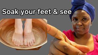 Soak your Feet in this things before sleep and wakeup with surprise results