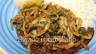 HÍGADO ENCEBOLLADO