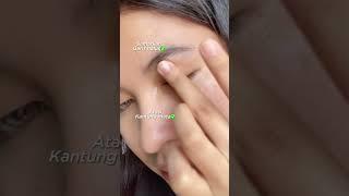 Area Mata Cerah dan Kencang Cuma Pakai Eye Serum ini