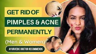 ULTIMATE Ayurvedic Routine to Get Rid of Pimples & Acne Permanently (Men & Women)