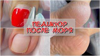 Педикюр после моря / Как делать аппаратный педикюр / Фрезы для педикюра