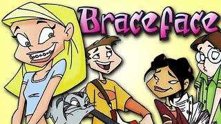 WAIT... Remember Braceface?