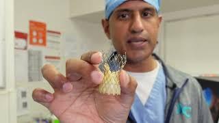 How the Medtronic Evolut FX+ is used in TAVR procedures to treat valve stenosis | BCH Boulder Heart