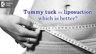 Tummy tuck vs liposuction which is better?