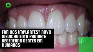 Fim dos implantes? Novo medicamento promete regenerar dentes em humanos